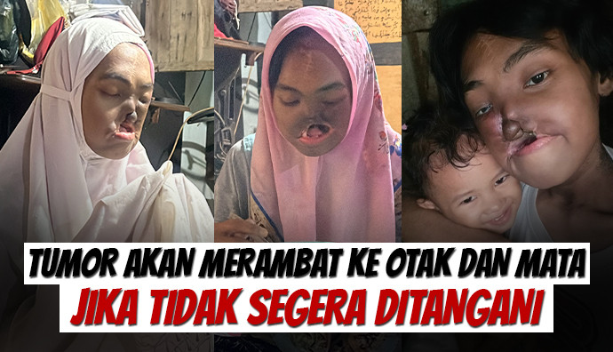 Update Kondisi Ibu Devi Tanggal 02 Maret 2026